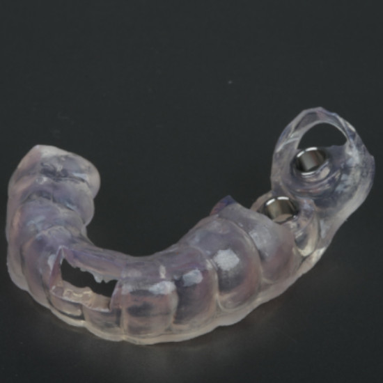 Guia cirúrgica impressa em 3D para implantes dentários