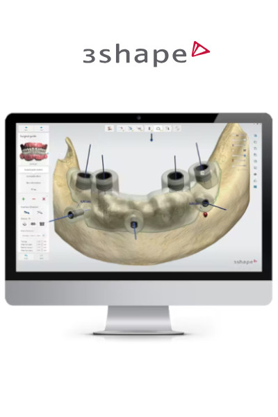 Planejamento de implantes no software 3Shape Implant Studio